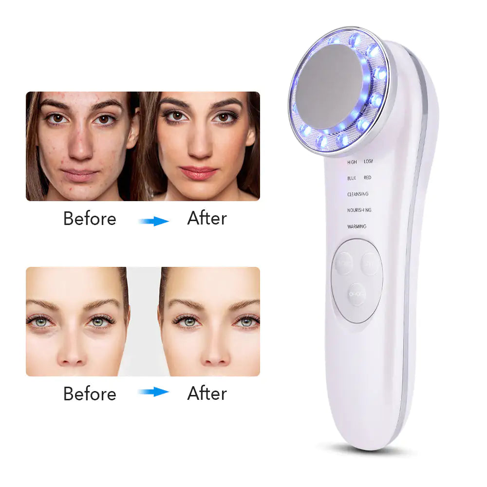 Re-Joove facial massager for lifting, toning, and skin smoothing